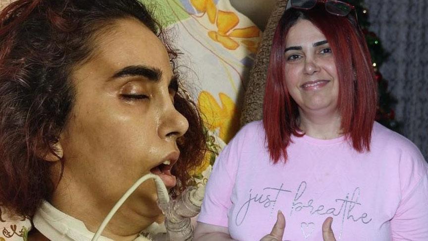 1 yılda hayatı karardı! 45 gün komada kaldı, beyin felci geçirdi: Doktorlar iyileşmemin mümkün olmayacağını düşünüyordu