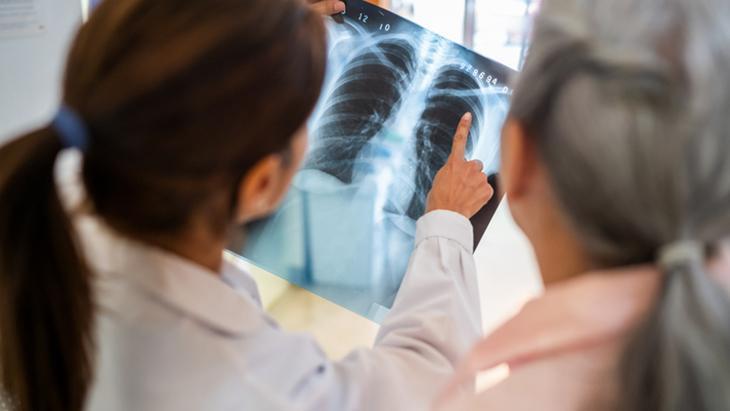 5 dakikalık kontrol hayatınızı değiştirebilir! Geçmeyen öksürük ilk belirtisiymiş