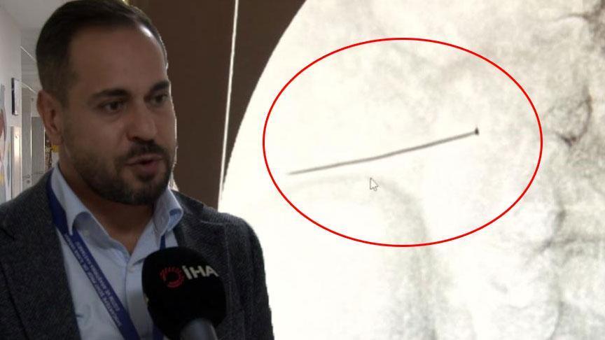 Ağrıyla kıvranan 2 yaşındaki çocuk doktorları şoke etti! ‘Ölümüyle sonuçlanabilirdi’