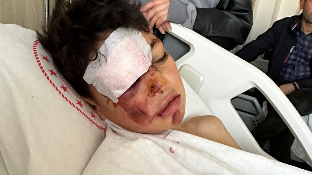 Aksaray’da 12 yaşındaki çocuğa çarpıp kaçtı