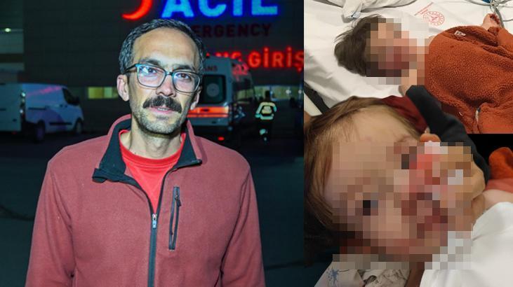 Başkentte pitbull dehşeti! ‘Ceza almalarını istiyorum, yoksa çocuğumun yüzüne bakamam’