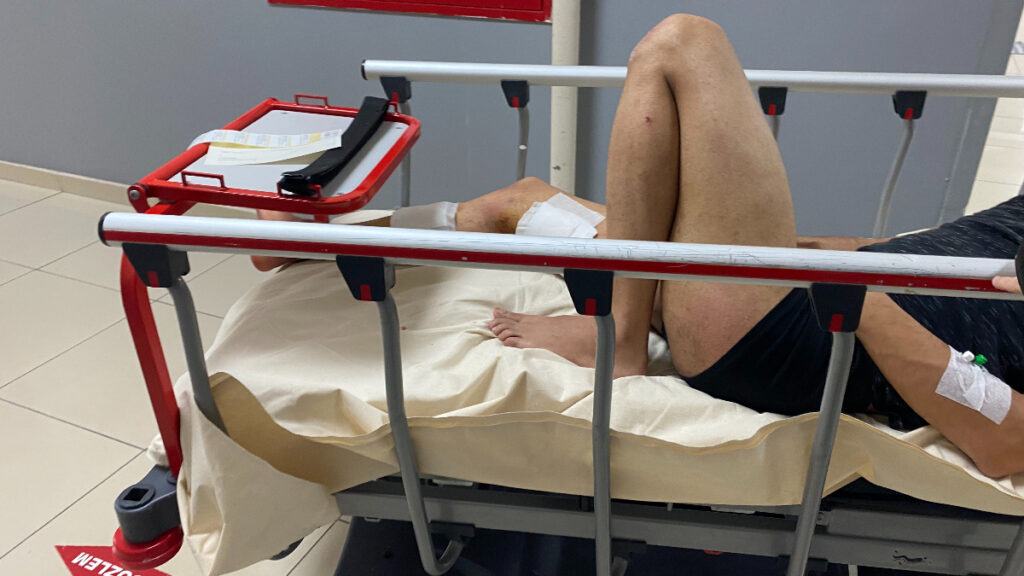 Bursa’da sigara vermedi, bıçaklandı