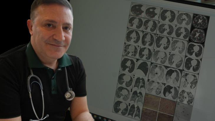 Gençlerde ani ölümler artıyor: ‘Nedeni ise virüsün damarlarda bıraktığı hasar’