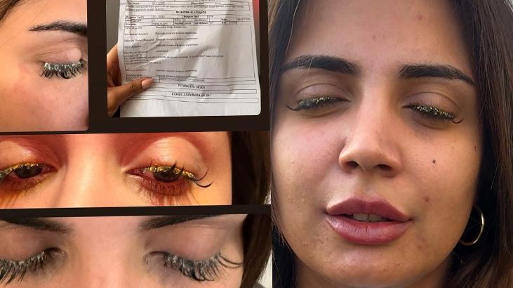 Güzelleşmek istedi, hayatı kabusa dönüştü: Gözlerim göremez hale geldi