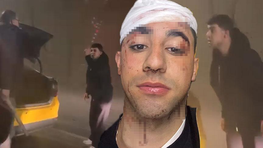 İstanbul’da taksici dehşeti! ‘Sopayla kafama 10 defa vurdu’