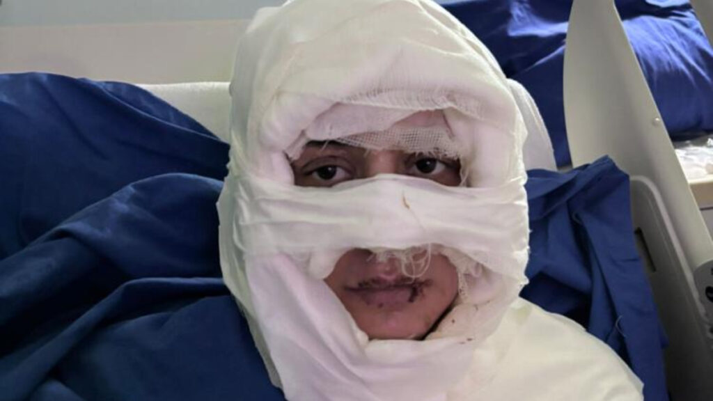 Kadıköy’de genç kadın, başka bir kadın tarafından ateşe verildi