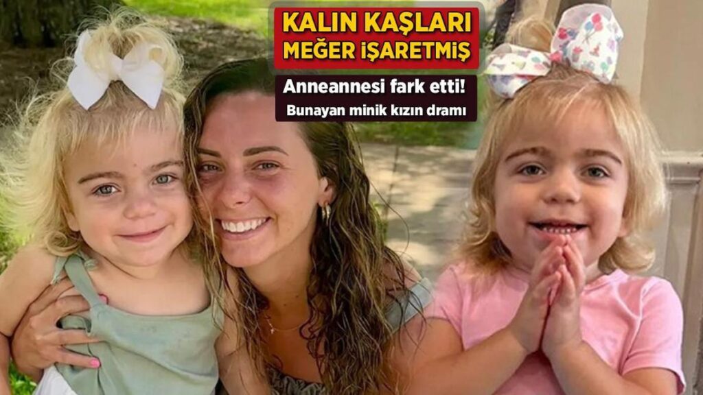 Kalın kaşları meğer işaretmiş! Anneannesi fark etti: Bunayan minik kızın dramı