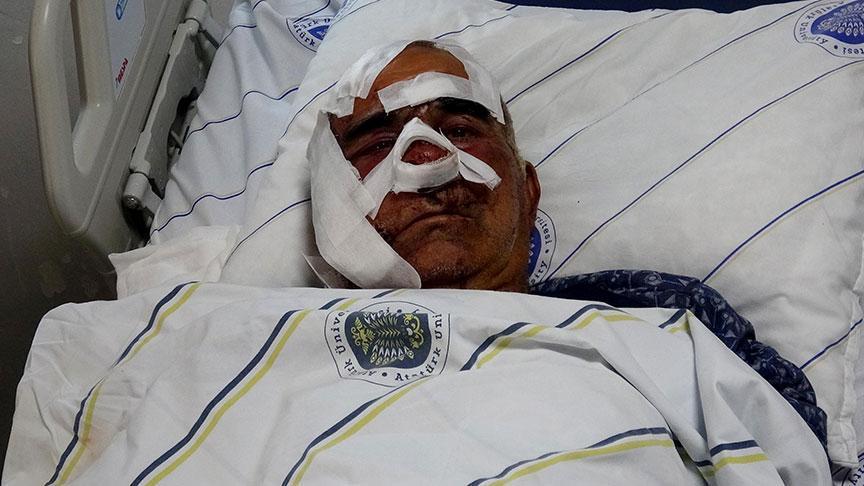 Kentte 5’inci ayı dehşeti! Hayvan otlatırken saldırdı: ‘Yüzünde çok büyük kesiler, yırtıklar vardı’