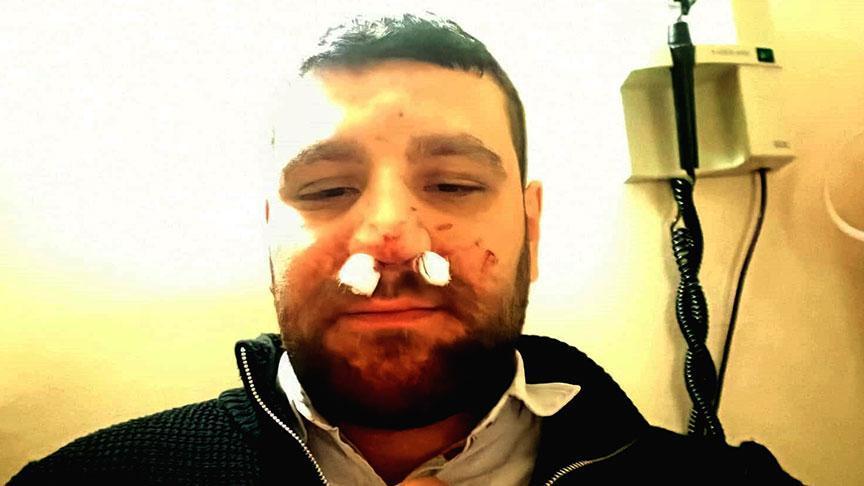 Trafikte yol verme dehşeti! Avukatın burnu kırıldı: ‘Elindeki cisimle vurdu, kafa attı’