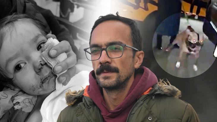 12 kez şikayet edilmiş: İlla çocuğumun suratının parçalanması mı gerekiyordu?