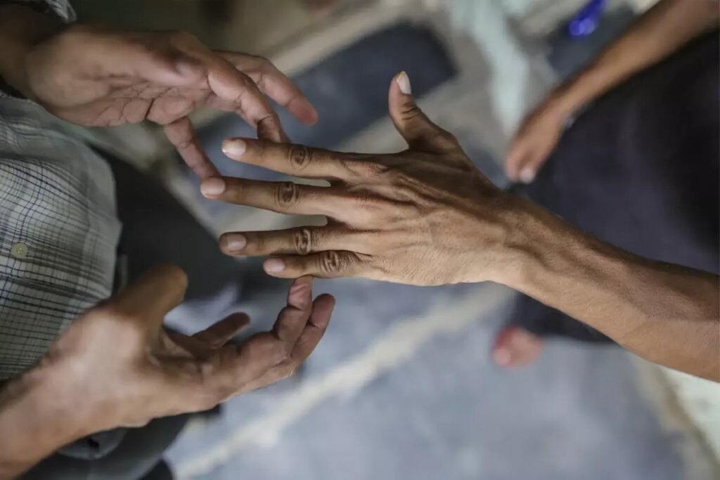 44 yıl sonra bir ilk! 2 ülkede cüzzam vakaları görülmeye başladı