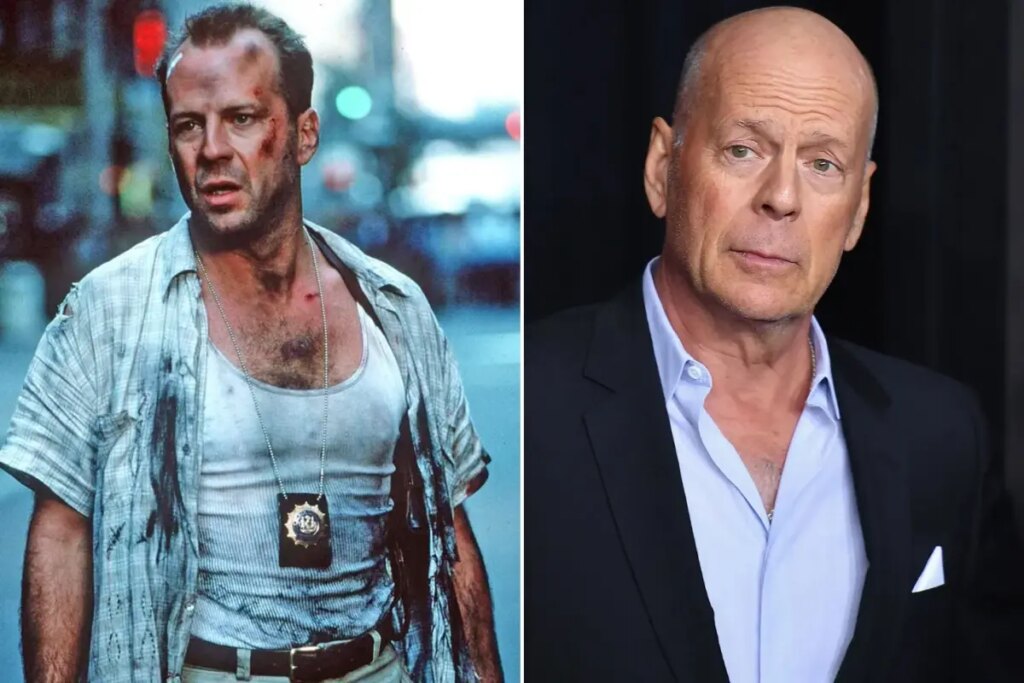 Ailesi Bruce Willis’in beynini bağışlama kararı aldı