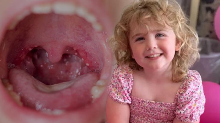 Bademcik ameliyatı 5 yaşındaki kızı hayattan kopardı! Ölümün ardındaki ‘tek gece’ detayı