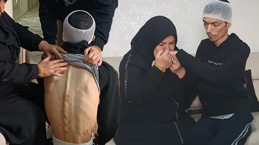 Bakımevinde engelliye darp skandalı! ‘Oğlumu görünce içim parçalandı’