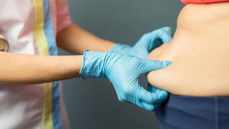 Kilo veremiyorsanız suçlu iradeniz değil! Genetik kodunuzda lipödem olabilir