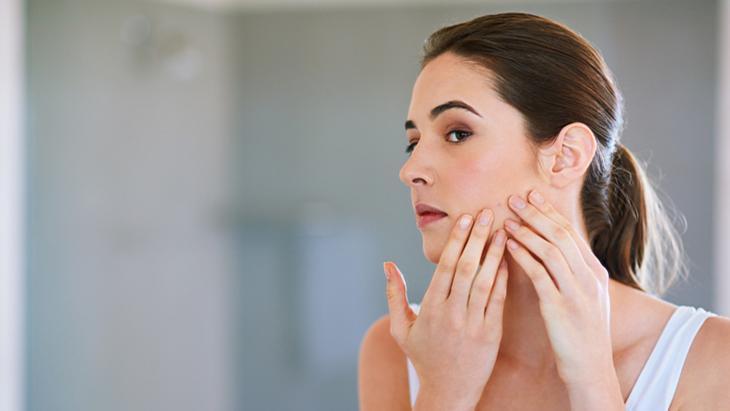 ‘Makyaj, hormonlar ve beslenme yetişkinlerde akne alarmı veriyor’