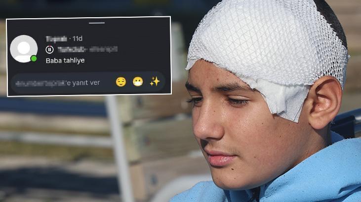 Okulda kan donduran zorbalık! Arkadaşının kafatasını parçaladı, ‘baba tahliye’ paylaşımı yaptı