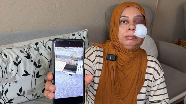 Elektrikli bisikletiyle rögara düştü! Dişleri kırıldı, yüzüne 14 dikiş atıldı