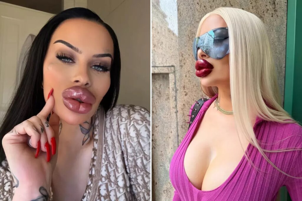 Estetiğe 60 bin dolar harcayan fenomen: Artık ağzımı kapatamıyorum