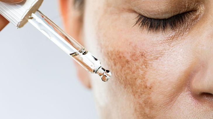 Her cilt sorununa aynı anda etki eden içerik: Azelaik asit! ‘Çok yönlü çalışıyor’