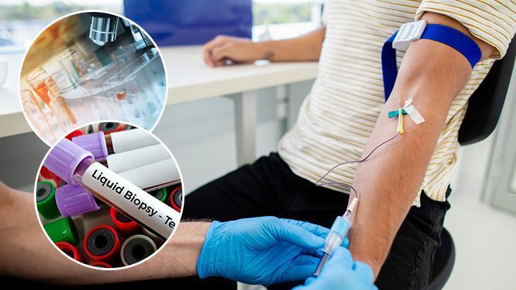 Koldan alınan bir tüp kanla kanser analizi! Onkolojide devrim gibi gelişme: ‘PET’ten aylar önce anlaşılabilir…’