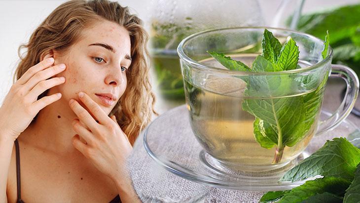 Sosyal medyada hızla yayılıyor! Kıvırcık nane çayı hormonal akneye iyi gelir mi?