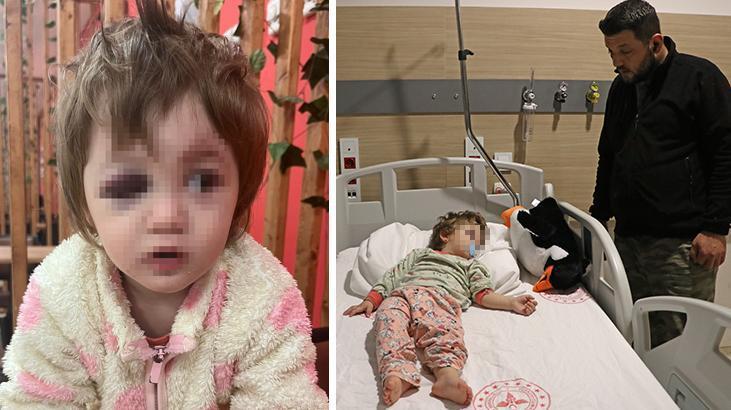 Yalova’da 14 aylık kızı ile birlikte darbedilen babadan yeni açıklama