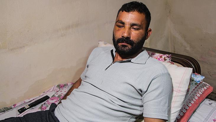 Adana’da işçi 12 metreden düştü! Hayat mücadelesi veriyor: ‘Ailemin tek geçim kaynağıydım’