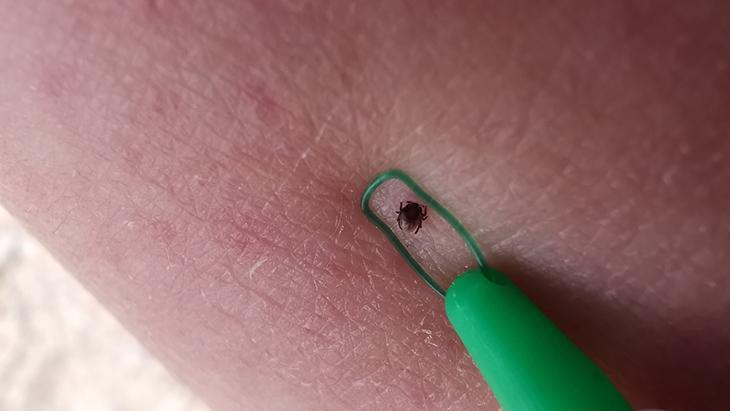 Halsizlik ve ateşi geçiştirmeyin! Keneye karşı uzmanlar uyardı: ‘Ciddiye alın’