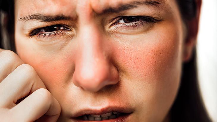 Yüzdeki ani kızarıklığa dikkat! Gül hastalığı sessizce ilerleyebilir
