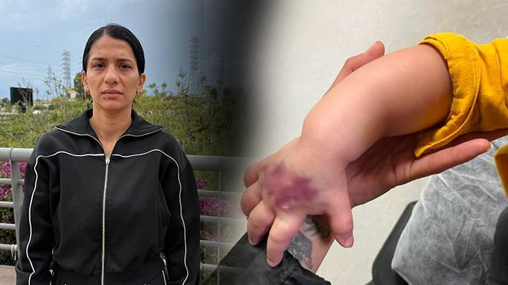 1,5 yaşındaki bebek tomografiyi alındı, kabus başladı: Çocuğumun kolu dirseğe kadar açıldı