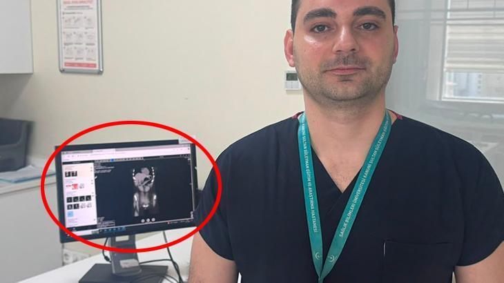 Zayıflamak uğruna kendine bunu yaptı! İstanbul’da doktorların inanamadığı vaka